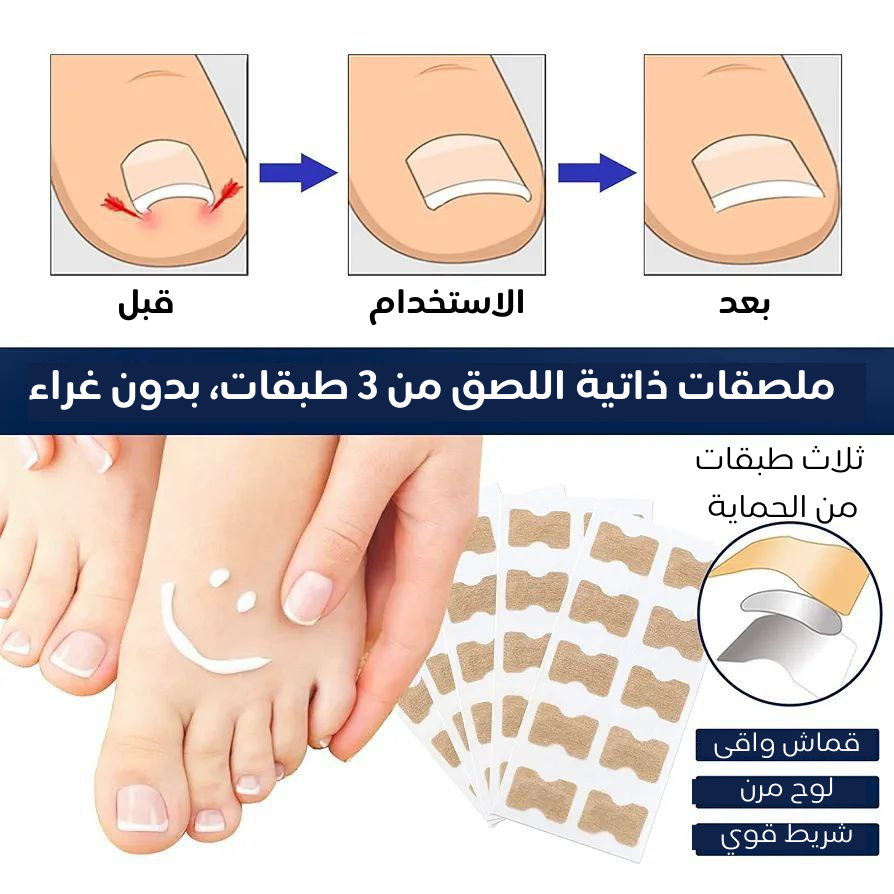 لاصقات علاج الأظافر